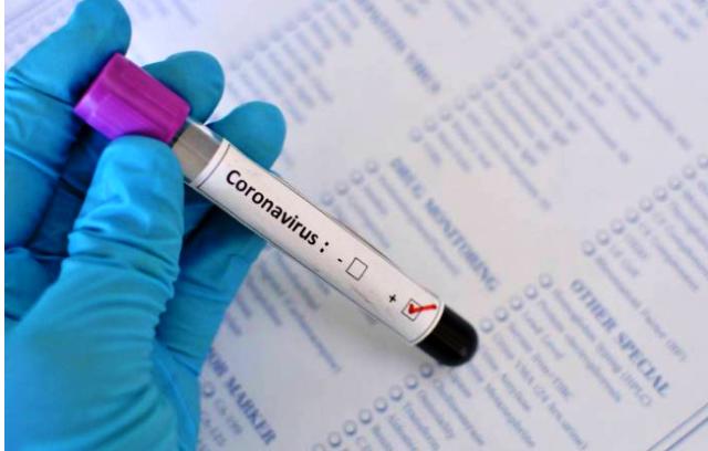 Vacinas contra coronavírus 