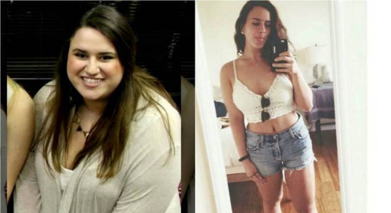 Mulher perde 70 kg com jejum intermitente, e muda de vida