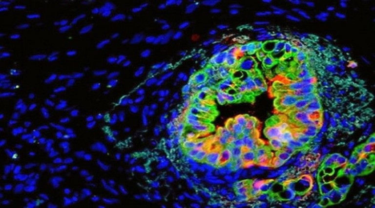 cientistas-identificam-a-condicao-chave-para-formacao-do-cancer