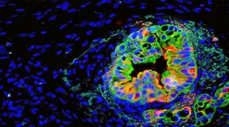 cientistas identificam a condicao chave para formacao do cancer