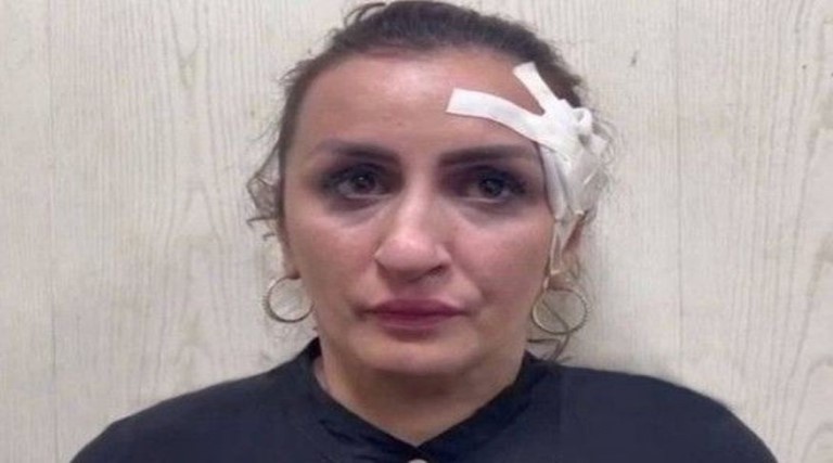 mulher-vende-seu-bebe-por-r-175-mil-para-financiar-plastica-no-nariz