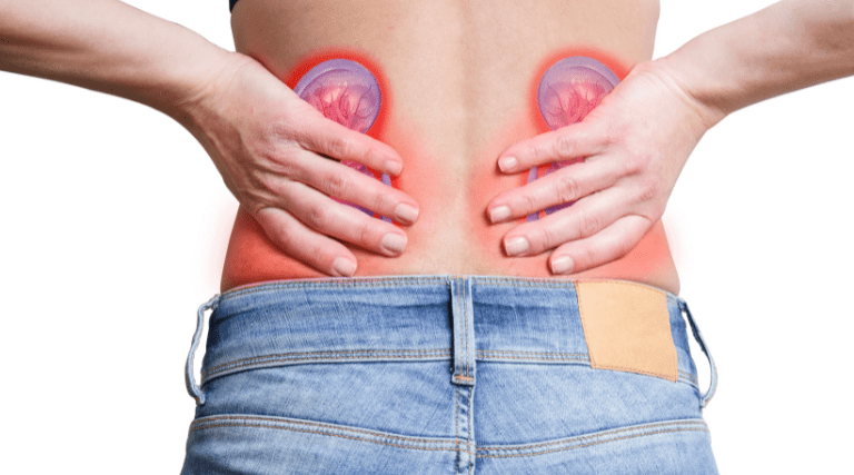 pedra-nos-rins-o-que-e-quais-sao-os-sintomas-e-como-prevenir