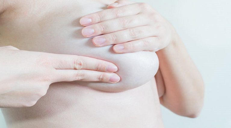 conheca os sinais do cancer de mama que aparecem na pele