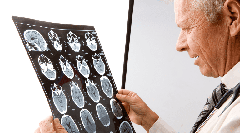 creatina pode recuperar memoria e traumas no cerebro mostra estudo