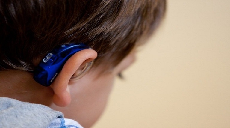 camara aprova projeto que considera deficiencia perda auditiva em um ouvido