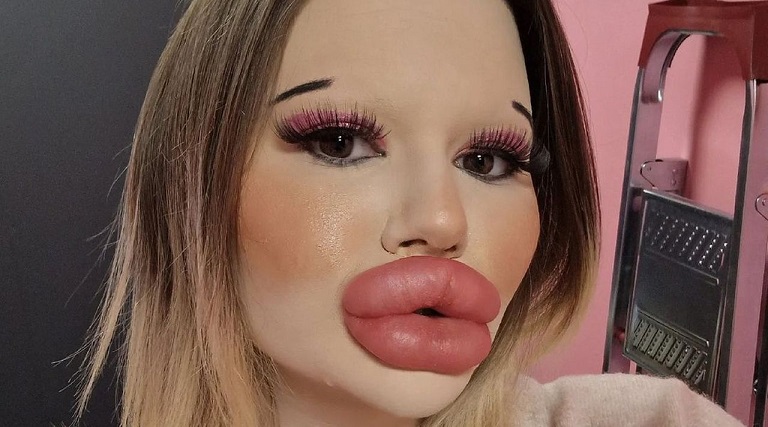 dona dos maiores labios do mundo busca novo recorde maiores macas do rosto