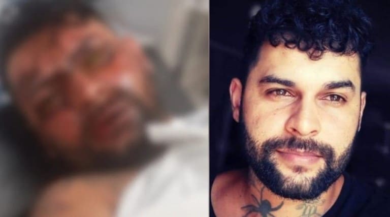 tatuador-fica-cego-apos-ex-namorada-jogar-soda-caustica-no-rosto-dele-em-saida-de-academia