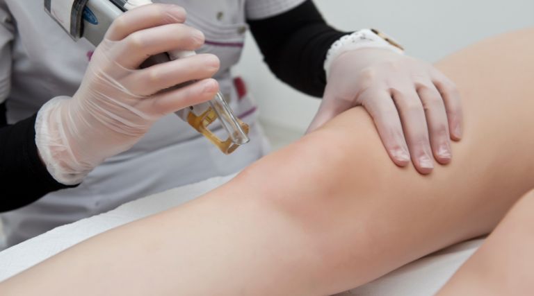 Nova terapia brasileira será usada para tratar câncer de pele no SUS