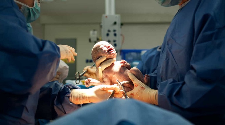 mulher em morte cerebral ha mais de dois meses da a luz bebe saudavel