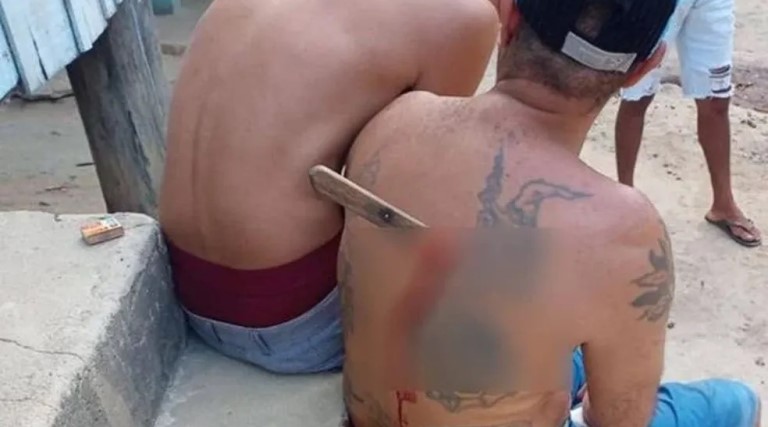 Homem fica com faca presa às costas após tentativa de homicídio no ES 1 homem fica com faca presa as costas apos tentativa de homicidio no es