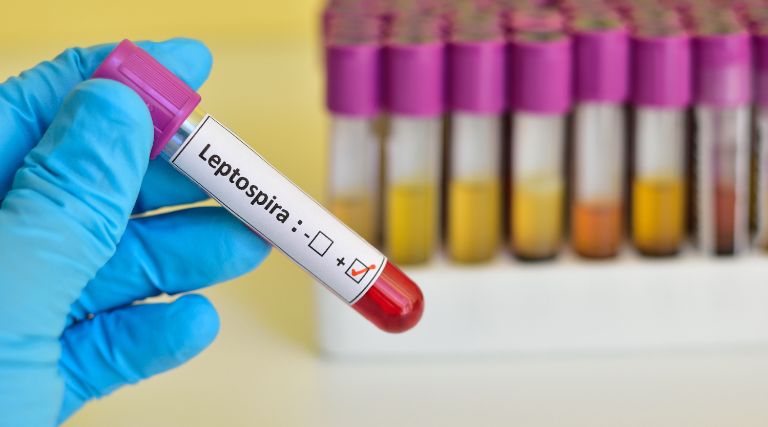 Leptospirose: Tudo sobre a doença que acometeu Junior Viana 1 Junior Viana Leptospirose