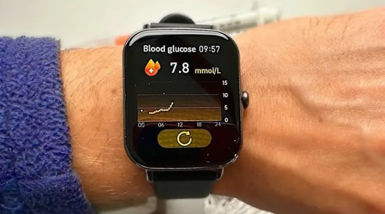 Anvisa proíbe relógio medidor de glicose 1 Anvisa proibe relogio medidor de glicose