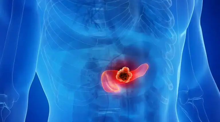 Cientistas espanhóis desenvolvem terapia combinada que elimina câncer de pâncreas em camundongos 1 Cientistas eliminam câncer de pâncreas em testes