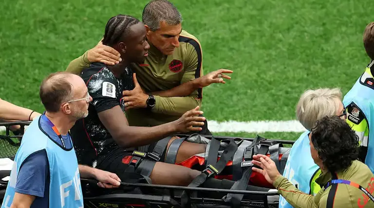 Jogador do Canadá quebra perna na Copa